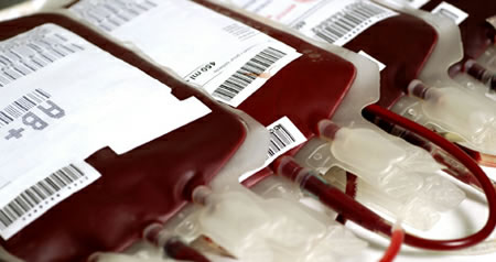 Hitno potrebna AB pozitivna krvna grupa u Podgorici